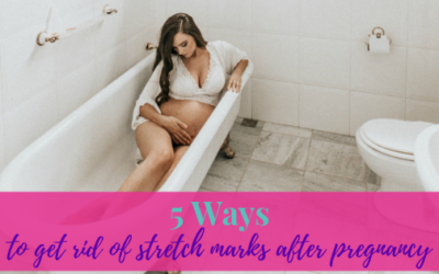 5 Ways to Get Rid of Stretch Marks After Pregnancy