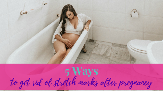5 Ways to Get Rid of Stretch Marks After Pregnancy